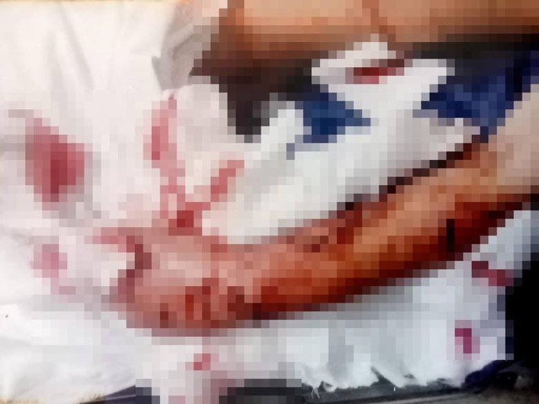 İzmir’de pitbull saldırısına uğrayan Soner, yaşadığı travmayı atlatamadı