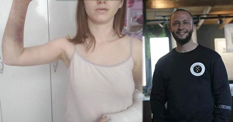 İzmir’de kız arkadaşını beyzbol sopasıyla darp ettiği gerekçesiyle tutuklandı