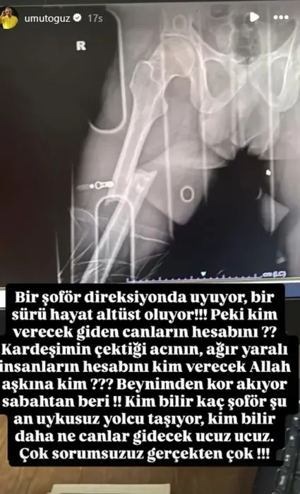 muglada-dehsete-dusuren-kaza-4-can-kaybi-yaralilar-arasinda-o-isim-de-bulunuyor-1787130225672.png