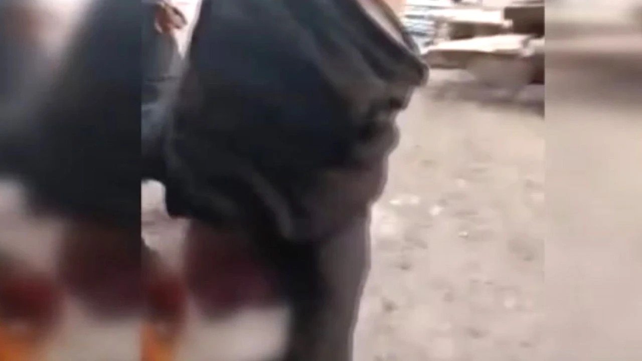 Ankara'da iğrenç olay! Zihinsel engelli adam ayaklarından vince astılar