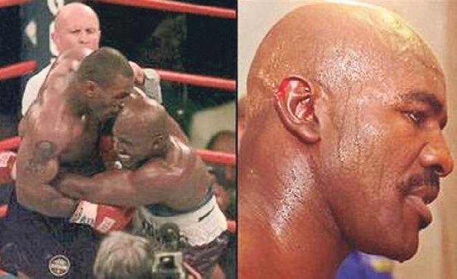 Denizlili Mike Tyson