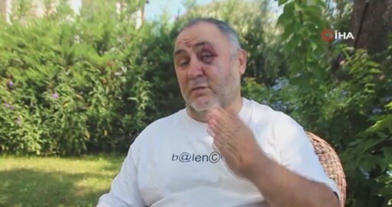 Patronlarını önce darp sonra gasp ettiler