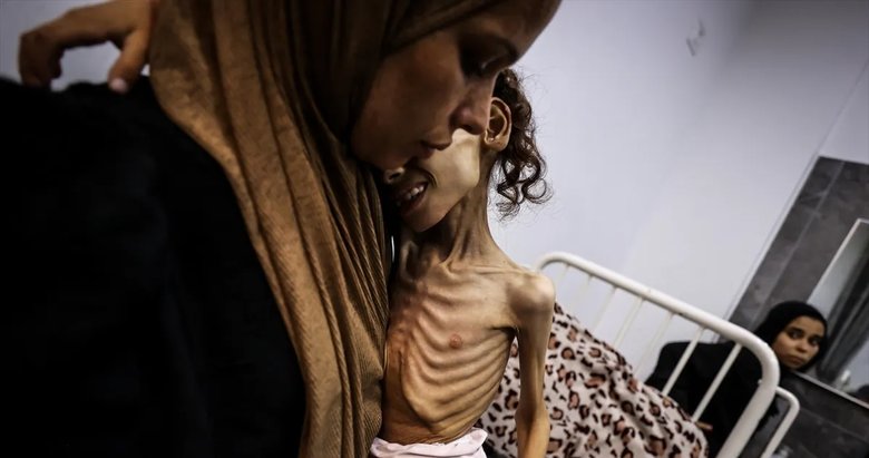 Gazze’deki Meryem ölümün eşiğinde