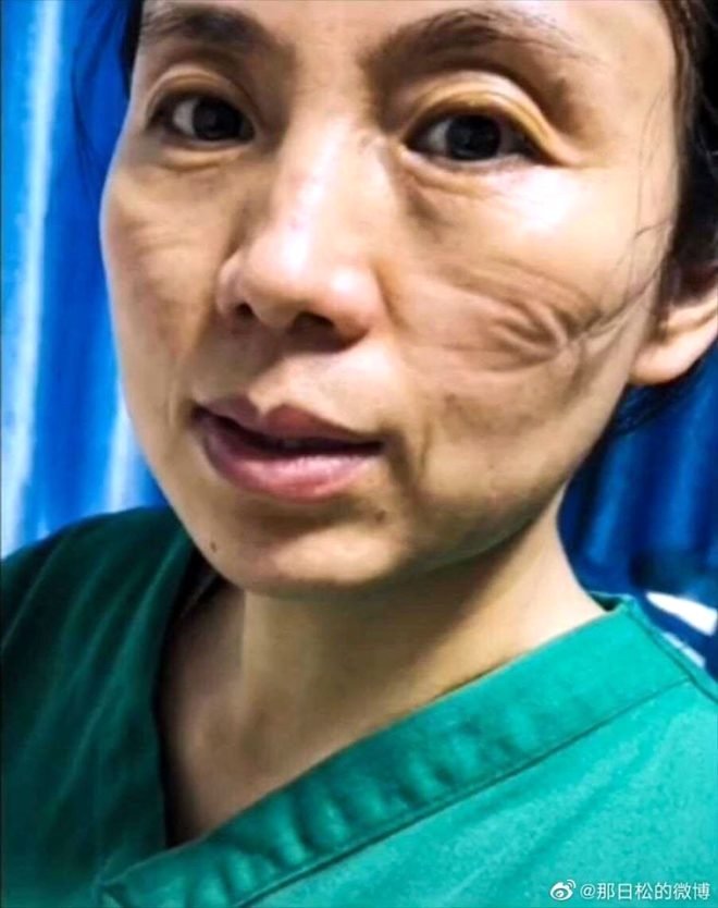 Çin’de koronavirüs hastalarının tedavi eden doktorların hali yürek burktu
