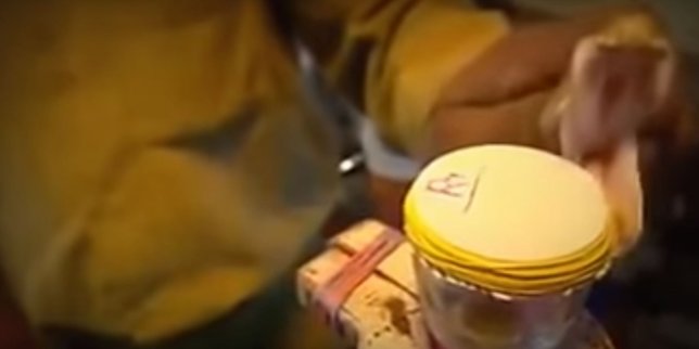 Yılan zehri kanı bakın ne hale getirdi! Görenler dehşete düştü