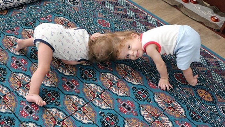 Son dakika: Başkan Erdoğan siyam ikizlerinin ailesiyle görüştü