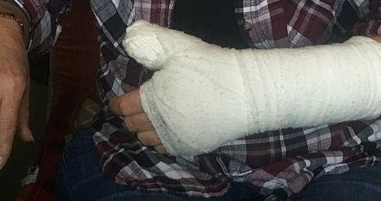 Pansuman için gittiği hastanede parmağı kırıldı