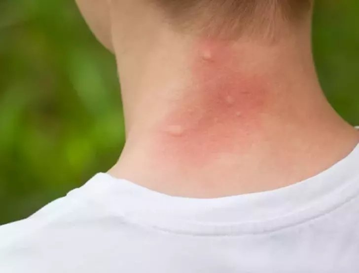 Hayat kolaylaştıran gizli kahraman: Karbonat!