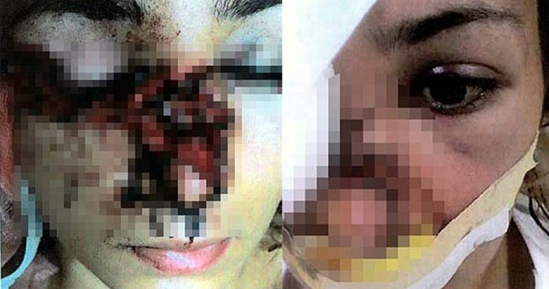 İzmir’de Tuğçe’nin yüzünün parçalandığı tüfekli saldırı davası ağır cezada