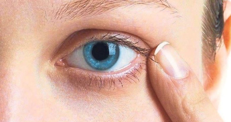 Katarakt Ameliyatlarinin Sayisi Giderek Artiyor Izmir Haberleri