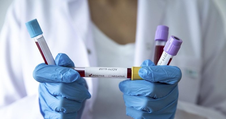 Bilim Kurulu üyesi uyardı: ’Çok daha hızlı bulaşıyor’