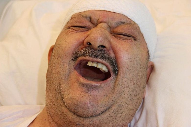 Diş ağrısı sanıp 6 sağlam dişini çektirdi! Gerçek çok başka çıktı